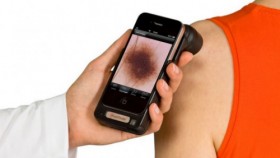 Специальное приложение для iPhone поможет в самостоятельной диагностике рак кожи