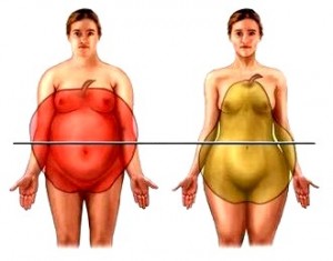 метаболический синдром, абдоминальный, или яблоковидный, тип ожирения
