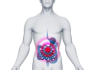 Полипы толстого кишечника и другие доброкачественные опухоли