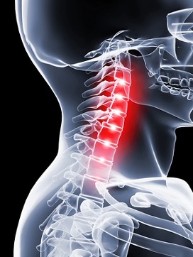 Основная причина болей в шее — мышечный спазм