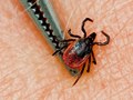 Опасность от клещей: 8 советов по отпугиванию и удалению насекомых