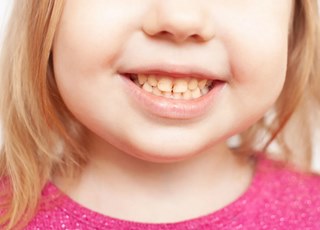 Почему у маленьких детей темнеют зубы