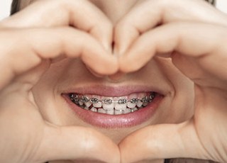 Неправильный прикус: причины аномалии и современное лечение Неправильный прикус: причины аномалии и современное лечение