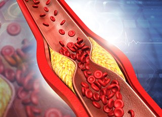 4 фактора, разрушающие артерии, и 4 фактора, поддерживающие их здоровье